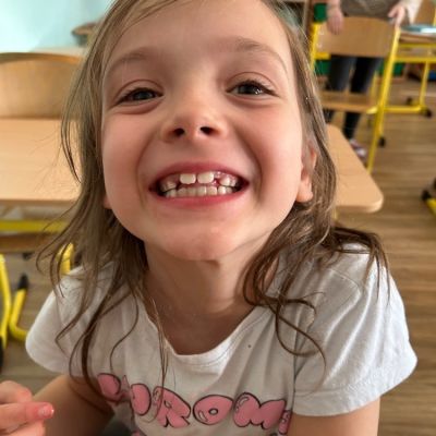 čokoládová lízátka