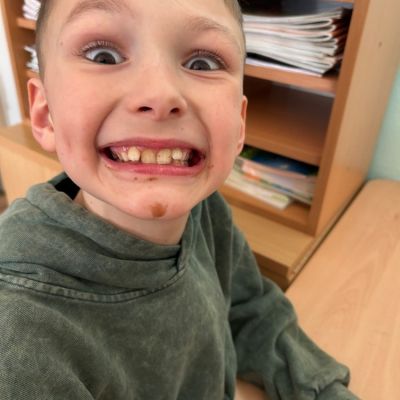 čokoládová lízátka